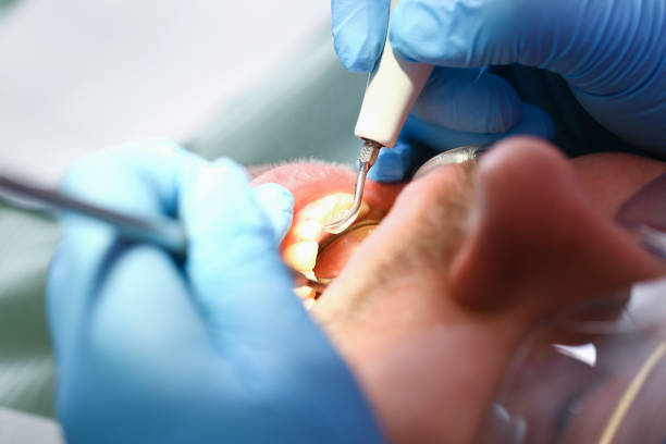 Best Mobile Emergency Dentist in Medina, TX