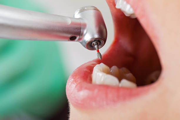 Best Orthodontic Emergency Dentist in Medina, TX
